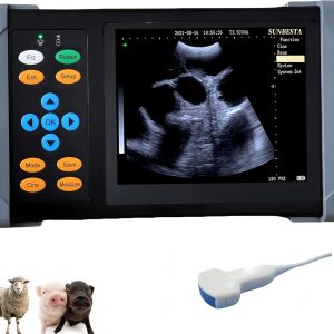 A20 Portable Ultrasound Machine for Pregnancy, at Home Ultrasound Mach...