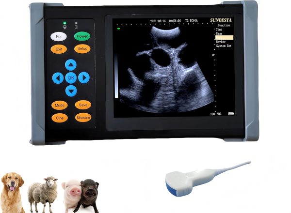 A20 Portable Ultrasound Machine for Pregnancy, at Home Ultrasound Mach...