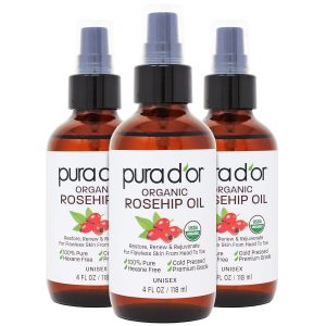 PURA D'OR ORGANIC Rosehip Seed Oil Hair Relaxer (4 Oz x3 = 12 Oz) 100%...