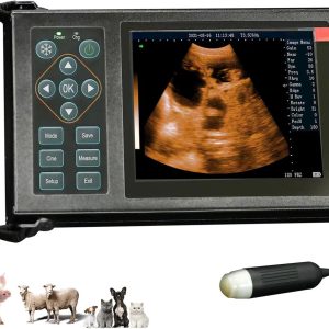 Portable Ultrasound Machine for Pregnancy, Easy to Use Handheld Ultras...