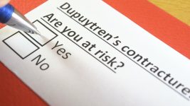 Can radiation therapy help people with Dupuytren's Contracture?