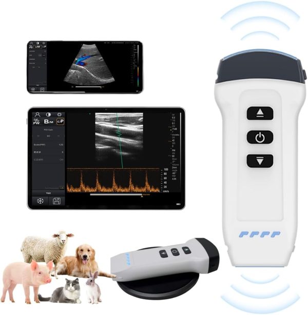 Dual Probe Wireless Color Doppler Ultrasound Machine 3.2MHZ and 7.5MHZ...