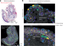 Location matters: defining the architecture of the bronchial wall in health and asthma