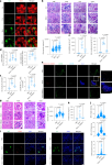 Mitochondrial DNA oxidation propagates autoimmunity by enabling plasmacytoid dendritic cells to induce TFH differentiation