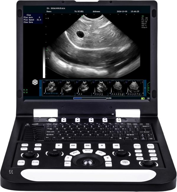 N60 Portable Veterinary Ultrasound Machine, PC-Based Ultrasound System...