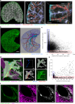 Neuroprotective liver portal area macrophages attenuate hepatic inflammation