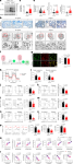 Targeting lactylation reinforces NK cell cytotoxicity within the tumor microenvironment