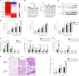 The RNA-binding E3 ligase MKRN2 selectively disrupts Il6 translation to restrain inflammation