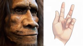 Unraveling the Genetic Threads of “Viking Disease”