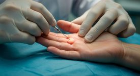 Needle Aponeurotomy
