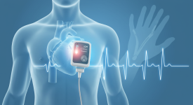 Insertable cardiac monitor detecting AF for Dupuytren's patients" "Long-term heart monitoring for stroke prevention in Dupuytren's"