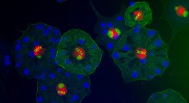 DNA helix and petri dish representing next-generation Dupuytren’s future therapies