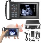 Portable Ultrasound Machine – 3.5Mhz Mechanical Probe Handheld B-Ultra…