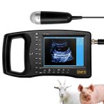 Portable Ultrasound Machine for Pregnancy – Digital Sonogram Machine w…