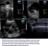S1 Veterinary Portable Ultrasound Machine for Pregnancy Vet Handheld S…
