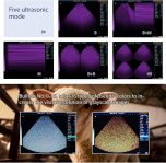 A20 Portable Ultrasound Machine for Pregnancy, at Home Ultrasound Mach…