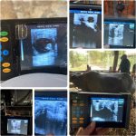 A20 Portable Ultrasound Machine for Pregnancy, at Home Ultrasound Mach…