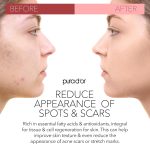 PURA D’OR ORGANIC Rosehip Seed Oil Hair Relaxer (4 Oz x3 = 12 Oz) 100%…