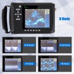 Portable Ultrasound Machine for Pregnancy – with 3.5MHz Convex Probe &…