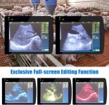 Portable Ultrasound Machine for Pregnancy – with 3.5MHz Convex Probe &…