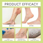 Miracle Balm for Leg & Body Massage Balm 2-Pack, Herbal Comfort Cream …