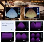 Portable Veterinary Ultrasound Machine M10 with 3.5 MHz Probe for Preg…