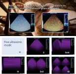 Portable Ultrasound Machine for Pregnancy, Easy to Use Handheld Ultras…