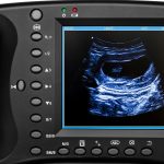 Portable Ultrasound Machine for Pregnancy – Digital Sonogram Machine w…