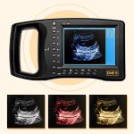 Portable Ultrasound Machine for Pregnancy – Digital Sonogram Machine w…