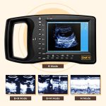 Portable Ultrasound Machine for Pregnancy – Digital Sonogram Machine w…