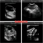 N50 Portable Veterinary Ultrasound Machine for Pregnancy, 15-Inch LCD …