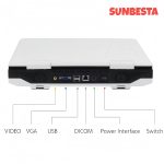 N50 Portable Veterinary Ultrasound Machine for Pregnancy, 15-Inch LCD …