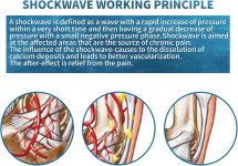 Focused Shock Wave Therapy Machine Multifunctional Body Muscle Massage…