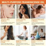 Frankincense Essential Oil, Frankincense Oil for Face, 100% Pure and N…