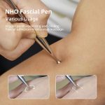 Acupuncture Pen Fascia Blaster 304 Stainless Steel Muscle Scraper Tool…