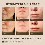 Gya Labs Frankincense Essential Oil for Face – 0.34 Fl Oz – 100% Pure …