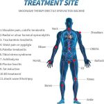 Focused Shockwave Therapy Machine, Extracorporeal Shock Wave ED Therap…