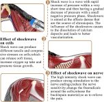 Adjustable Intensity Shockwave Therapy Machine, Touch Control 10-300MJ…