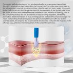 Shockwave Therapy Machine, Pneumatic Extracorporeal Massager, Muscle &…