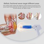 Shockwave Therapy Machine, Extracorporeal Physical Therapy, Body Muscl…