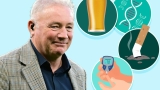 Are you at risk of ‘Viking’s disease’? All you need to know as Ally McCoist reveals incurable diagnosis