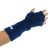 Benik W-711 Forearm Based Radial Nerve Splint, Right, Small/Medium, Fo…
