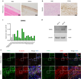 C-X-C domain ligand 14-mediated stromal cell–macrophage interaction as a therapeutic target for hand dermal fibrosis