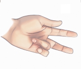 Disease That Permanently Bends Fingers Could Have Origins in Neanderthal Genes