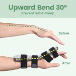 Radial Nerve Palsy Splint for Wrist Drop, Adjustable Static Fingers Fi…