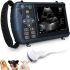 Portable Ultrasound Machine for Pregnancy – Digital Sonogram Machine w…